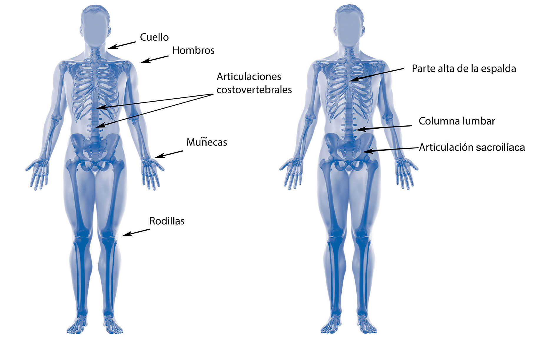 icopicas