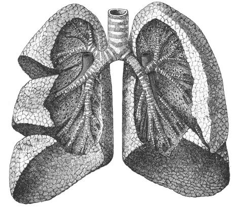pumones_epoc