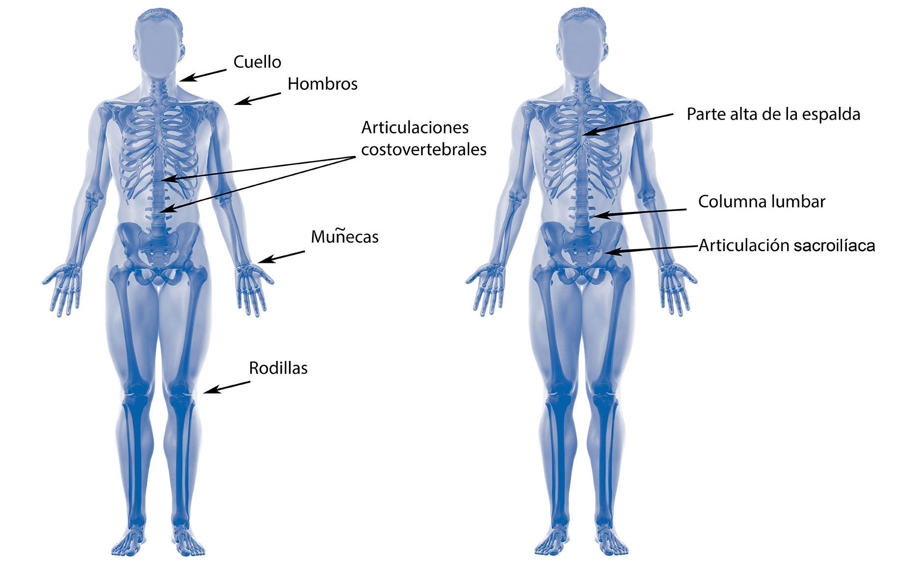 icopicas