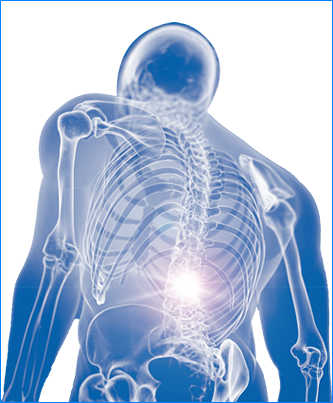 Espondilitis anquilosante - dolor lumbar inflamatorio