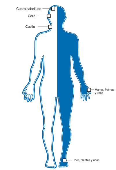 Partes del cuerpo afecta