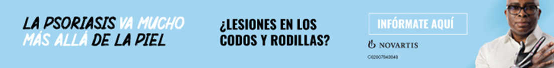 Psoriasis banner