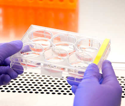 Psoriasis research Psoriasis research
