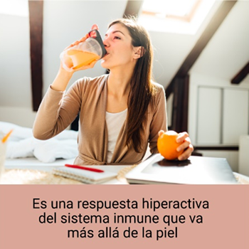 Es una respuesta hiperactiva del sistema inmune que va más allá de la piel