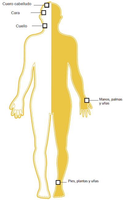 Partes del cuerpo afecta Partes del cuerpo afecta