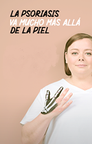 la psoriasis va much mas alla de la piel